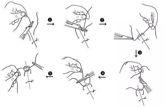 持针钳打结法(√) 剪线方法(√) 正确剪线方法是手术者结扎完毕后,将