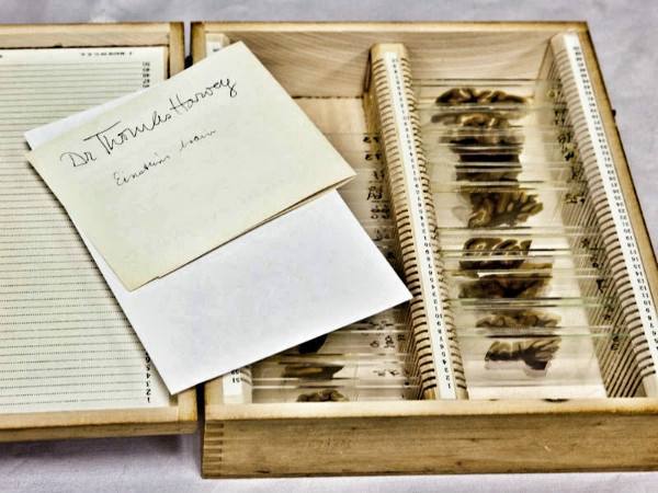 爱因斯坦|从“学渣”考试1分，到著名物理学家!爱因斯坦的大脑切片，发现了什么？