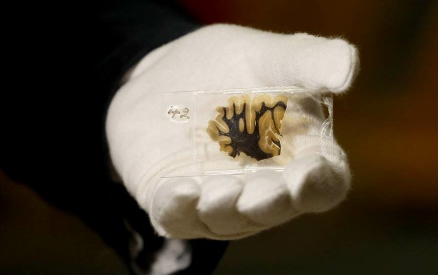 爱因斯坦|从“学渣”考试1分，到著名物理学家!爱因斯坦的大脑切片，发现了什么？