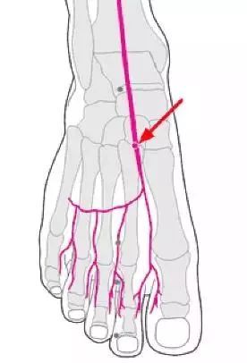 2,穿刺方法(1)病人取卧位或坐位,下肢伸直足背伸.
