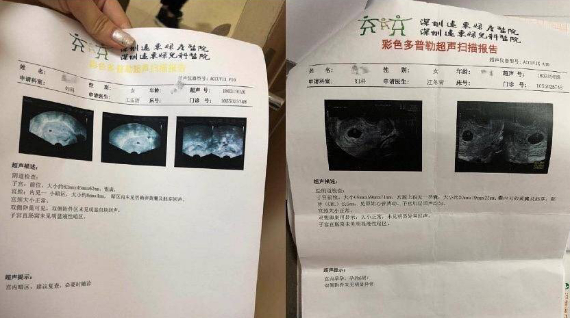 邓超元|娱乐圈的异性越亲密，越是友情？