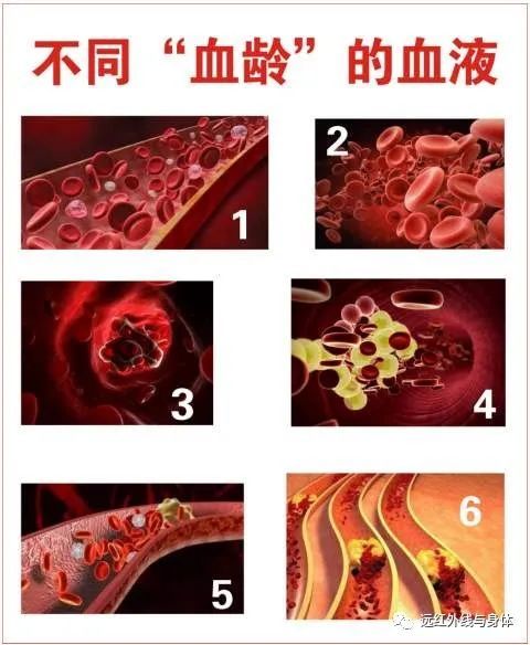 血液变得粘稠,就会伤害到毛细血管