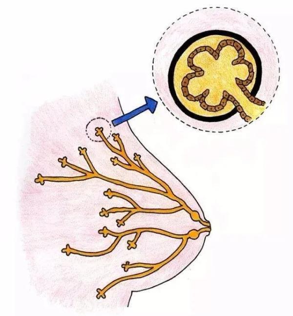 乳頭溢液是正常的嗎