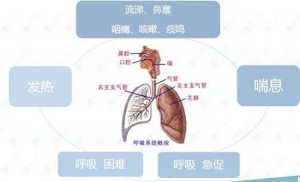 秋冬季打响呼吸道疾病防御战孩子出现哪些症状需要提高警惕