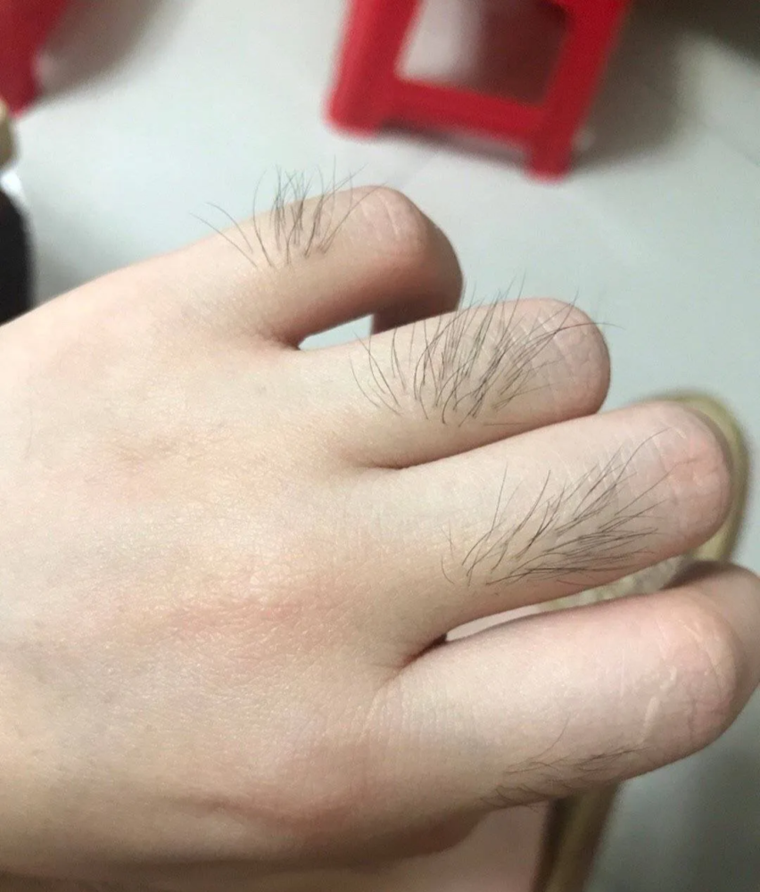 "女生汗毛太多的烦恼!对不起……我认输了!"哈哈哈哈哈哈哈