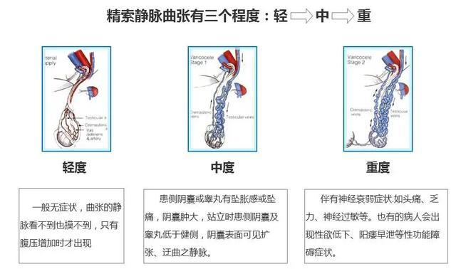 18岁小伙因精索静脉曲张,与当兵梦擦肩而过
