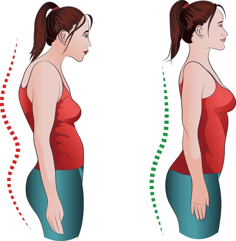 从侧面看,驼背的人正是因为背部肌肉力量差,而前侧的肌肉相对强一些