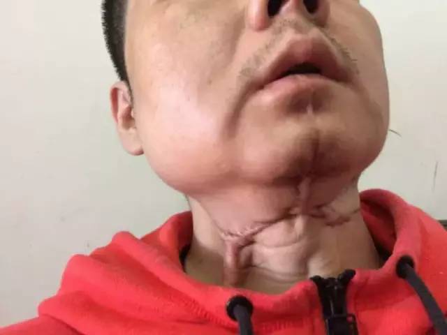 是他们,把口腔癌送给了7000万湖南人!