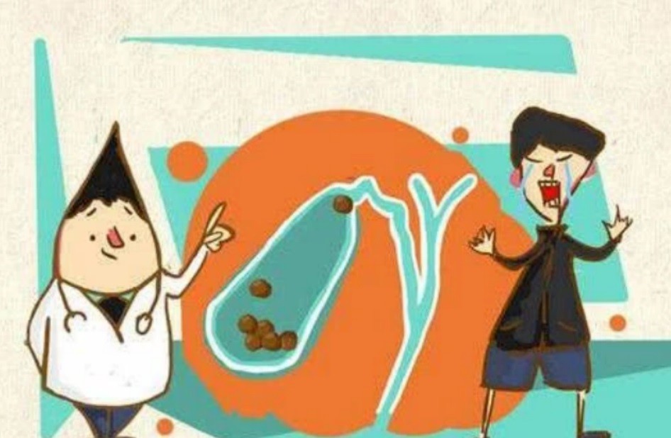 胆囊息肉|查出胆囊息肉应该怎么办？坐等切胆吗？