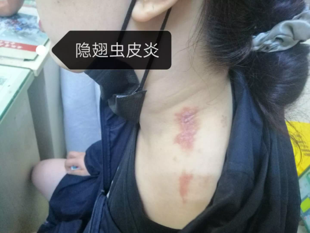 安徽已有人中招!