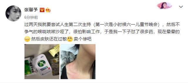 张馨予|张馨予做公益首次挑战当主持人，与尹颂同台，一身白色正装气质佳