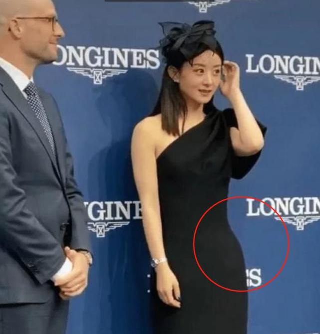 7%的孕产妇出现过不同程度的耻骨联合处疼痛,其中早孕期约 12%孕妇有