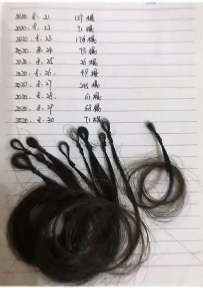 网友记录自己12天会掉多少头发,看着看着就哭了!