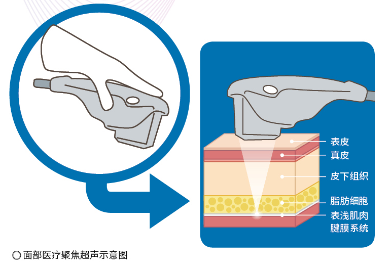 超声波|嘘，除了留声机里的痕迹，声音还有其他秘密……
