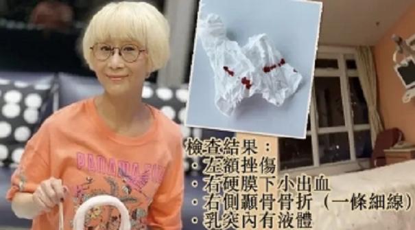 陈曼娜|TVB68岁绿叶陈曼娜高处坠落，脑部骨折出血，出院后表哥谭炳文却离世