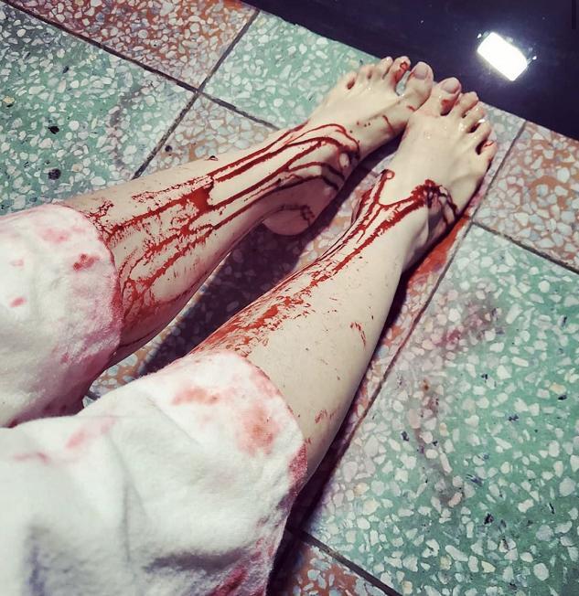 蔡依林晒双腿流血照,脚下地板都被染红,经纪人亲自回应曝近况|蔡依林