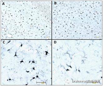 小胶质细胞|最新综述：小胶质细胞如何影响Tau病理？
