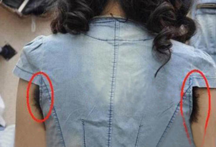 为什么有人的腋下不长毛或许是这3个原因网友再也不羡慕了