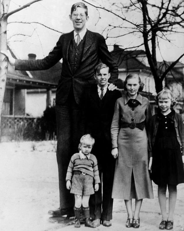 身高2.72米,22岁去世的"温和巨人",至今无人打破此世界纪录