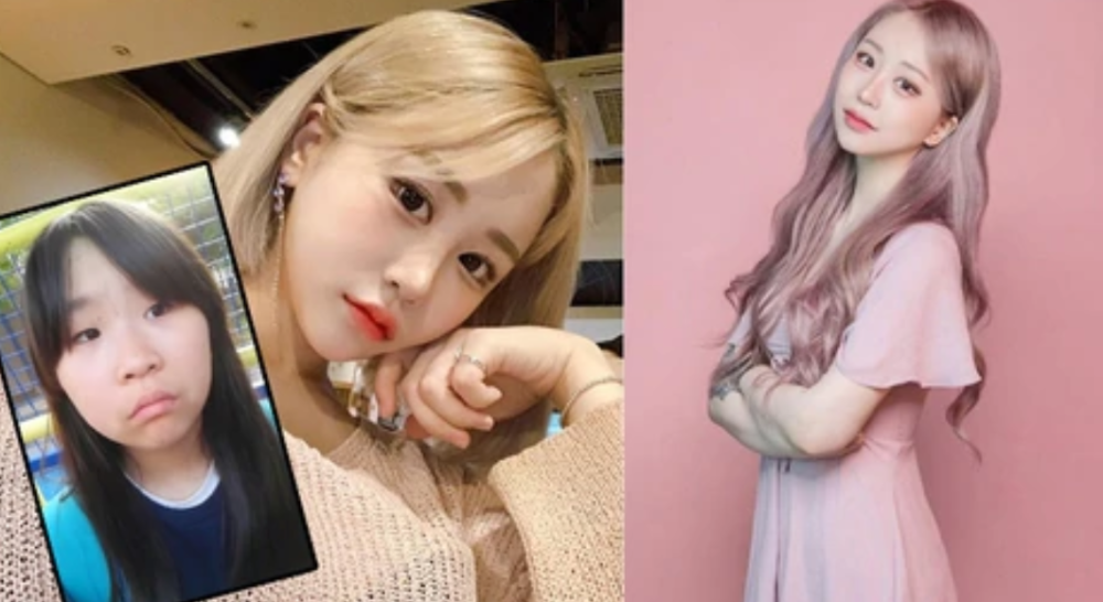 网红|20岁韩国网红自曝全身动刀被批整容上瘾，本尊保证将暂停两年