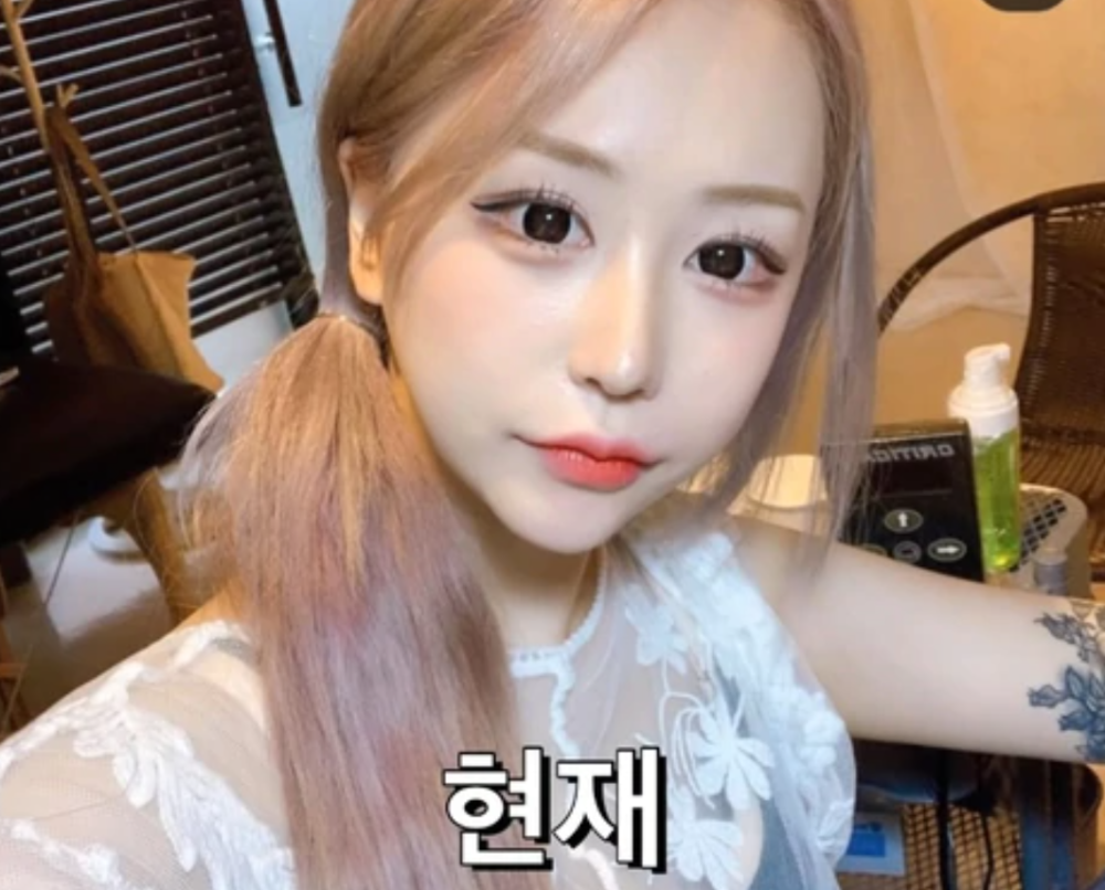 网红|20岁韩国网红自曝全身动刀被批整容上瘾，本尊保证将暂停两年