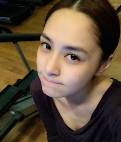 钟欣潼|阿娇突发意外头部受伤！伤势过重已经送医，霍汶希、容祖儿得知后火速前往
