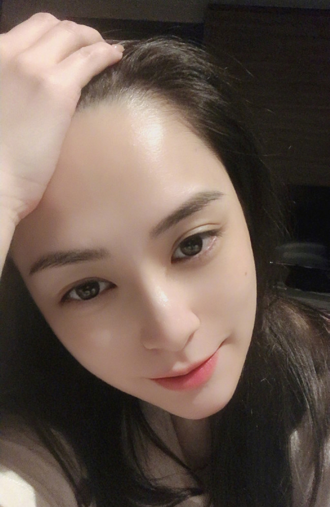 钟欣潼|英皇透露阿娇头部伤势严重，想坚持先拍戏遭霍汶希拒绝