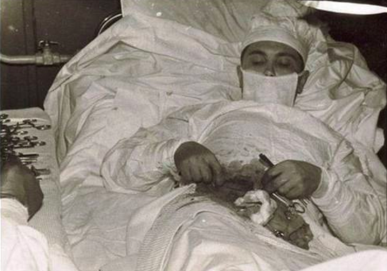 外科|我给自己做了一次手术：真正的外科猛士，敢于砍自己一刀