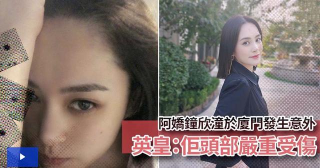 钟欣潼|阿娇酒店里发生意外，头部严重受伤，仍坚持要拍戏太敬业