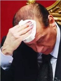 新冠病毒|植发界的“名人”今年84岁他却感染了新冠病毒