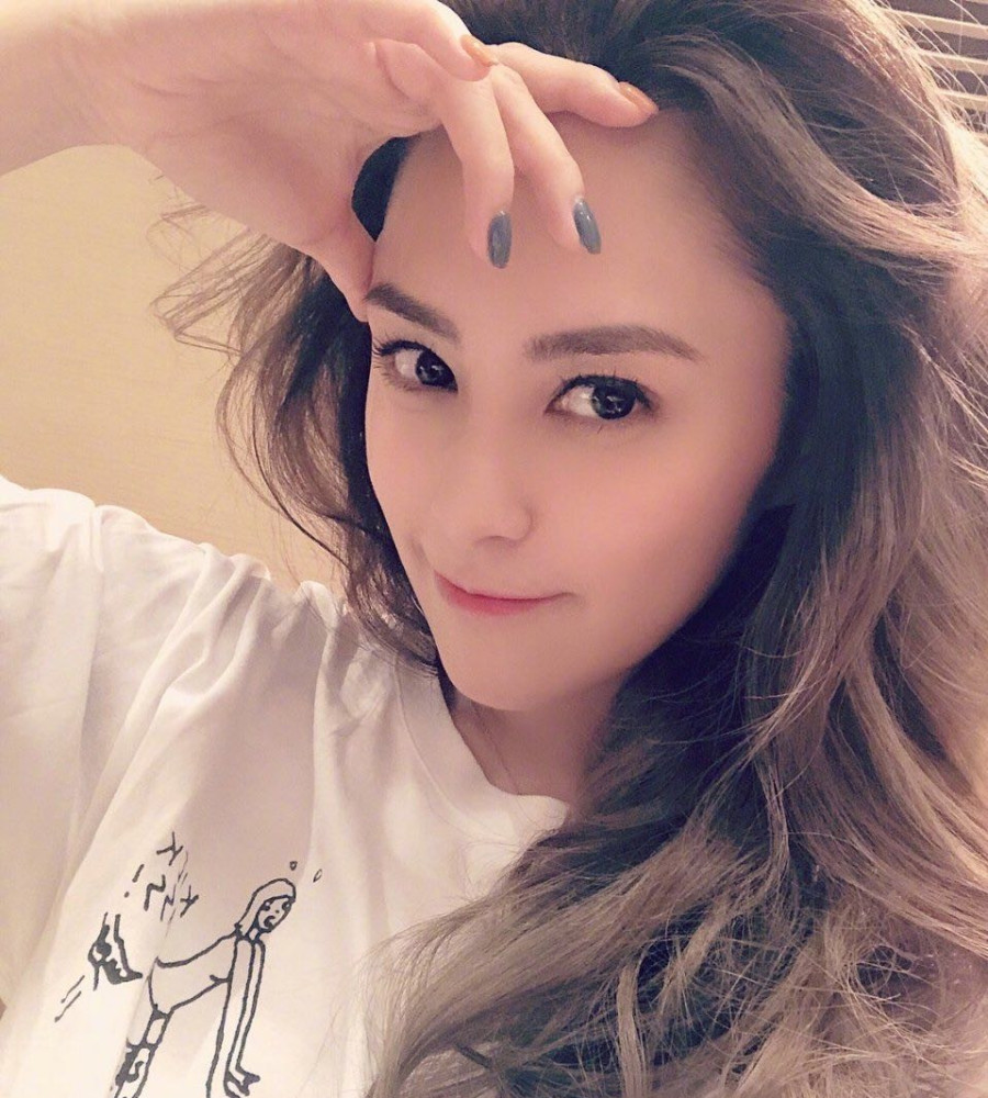 钟欣潼|阿娇受伤过程及住院照曝光，老板杨受成正式回应：需要做二次手术