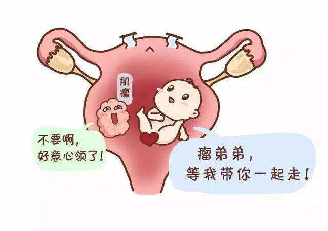 怀孕后才发现子宫肌瘤,怎么办?