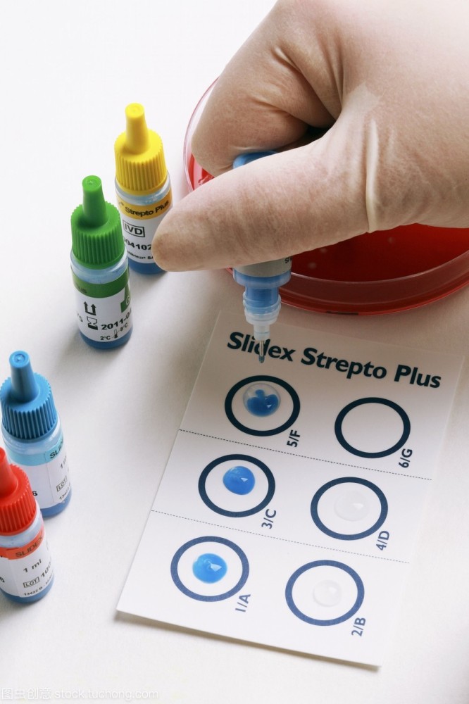 常用血清学检测方法介绍