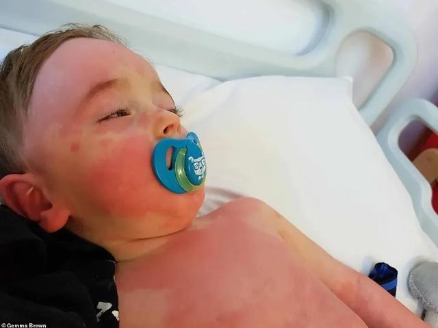 儿童|外媒：儿童感染新冠后可患罕见疾病，90％心脏受损，或伴随一生