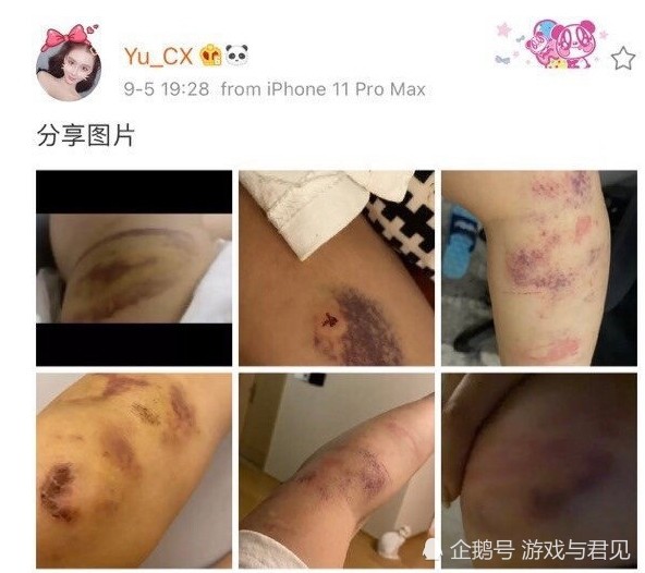 死亡宣告女友