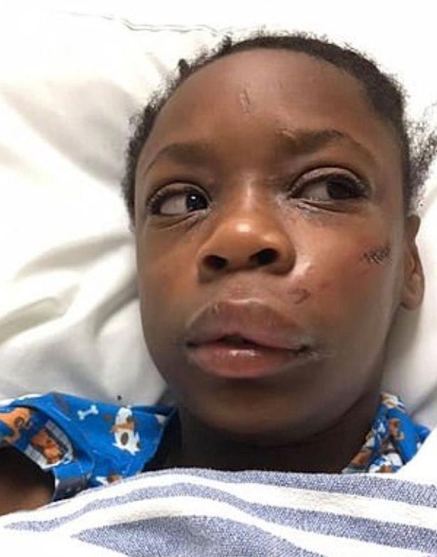 美国黑人小女孩惨遭白人小孩殴打只因一句我的黑皮肤很漂亮