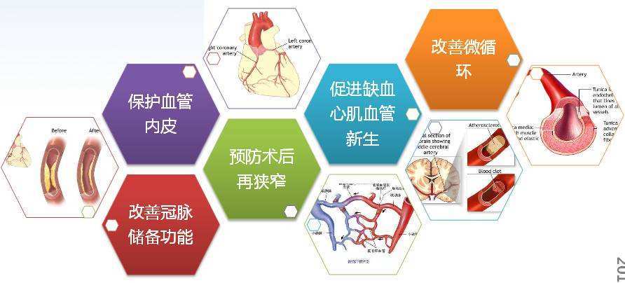 什麼是冠心病冠心病有什麼症狀