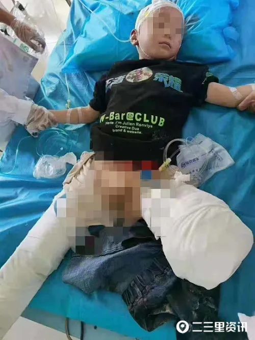 陕西6岁男童被火车轧断腿!系从幼儿园后门跑出