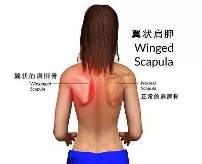 你所羡慕的蝴蝶背竟是一场美丽的错误赶紧自查纠正