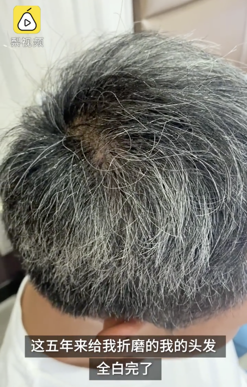 一个包工头的漫漫讨债路:35岁满头白发,借钱结清民工工资_腾讯新闻