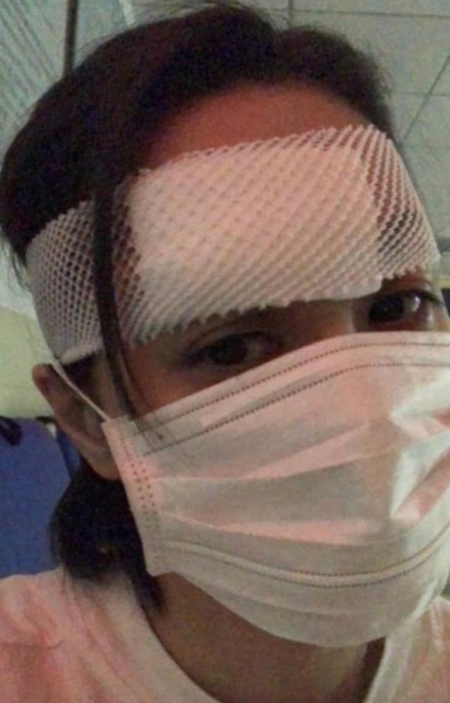 钟欣潼|阿娇伤势严重深可见骨！为防毁容缝几百针，任达华介绍整形科医生