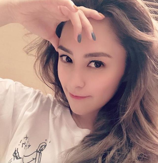 钟欣潼|阿娇伤势严重深可见骨！为防毁容缝几百针，任达华介绍整形科医生