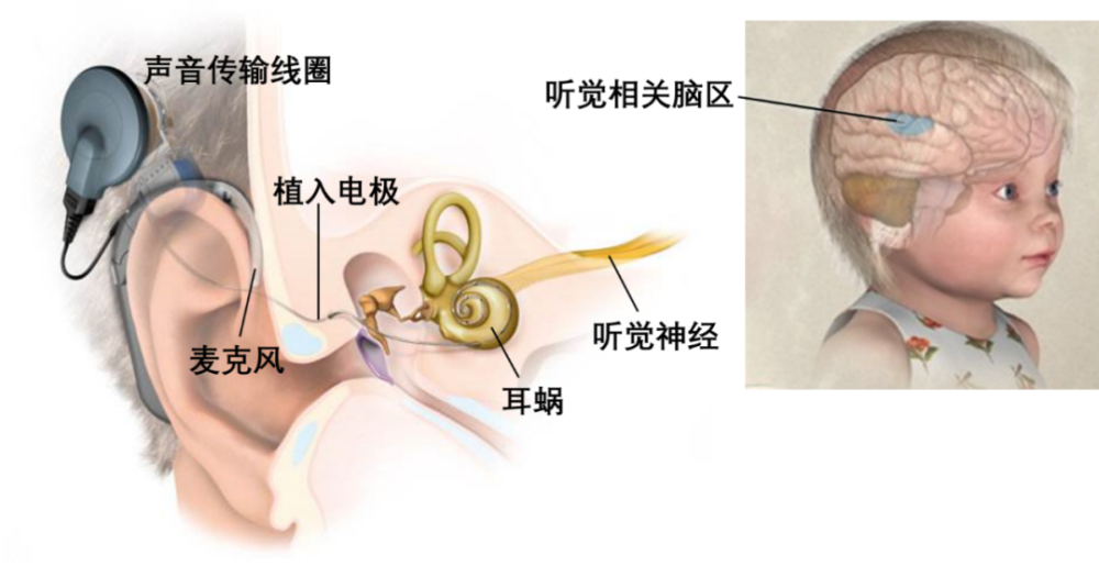 脑机接口|他的脑机接口被学术大佬齐踩，但我还是想夸一下这位梦想家