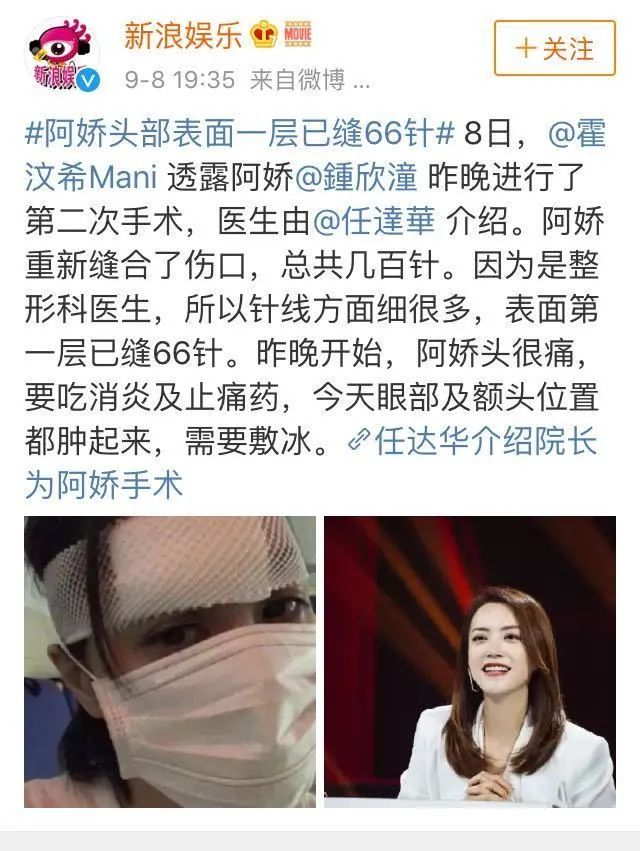 钟欣潼|受伤引出闺蜜情深，没想到她的朋友圈这么豪华？