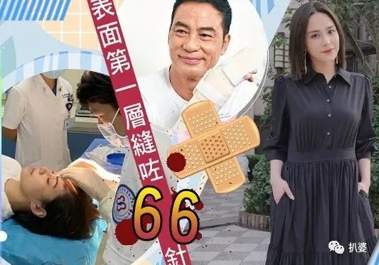 钟欣潼|离奇受伤的阿娇，又有新故事了