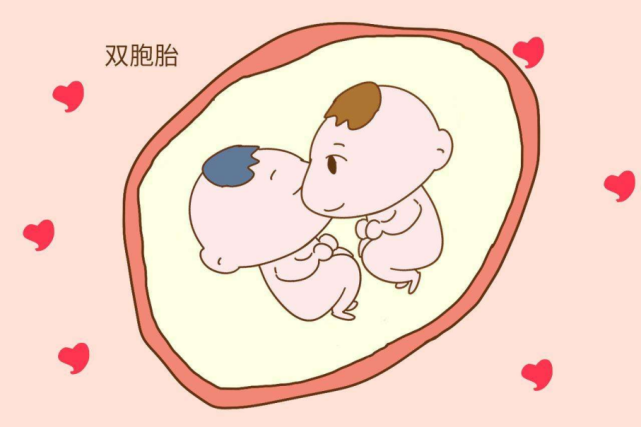 听说高龄产妇容易怀双胎