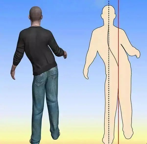 脑梗死|人到中年，不想脑梗死，远离一物，做到二个坚决，让你生活更健康