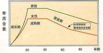骨质疏松|女人过了50岁，瘦点好还是胖点好？别被“千金难买老来瘦”误导