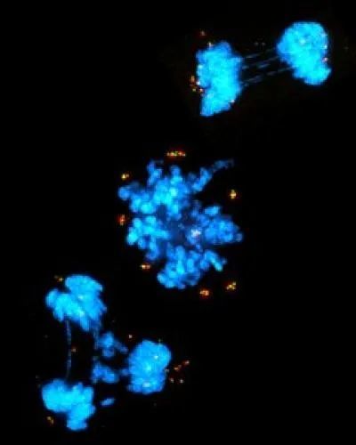 癌细胞|同日两篇《自然》：科学家找到了一些癌细胞的软肋