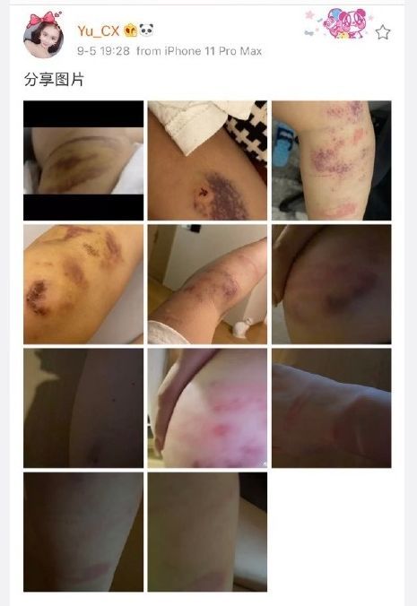 死亡宣告打女友事件再次反转,女友改口承认家暴事实,如何评价二人的